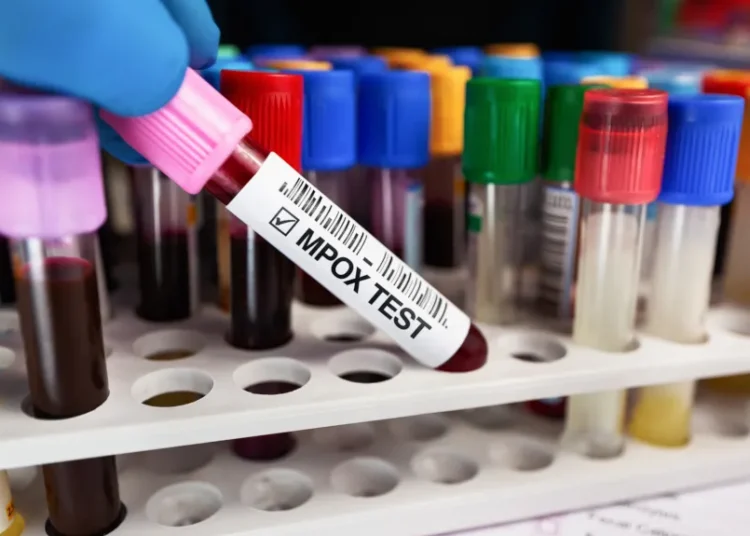 Mpox: Ανοίγουν άλλα 5 εμβολιαστικά κέντρα στην Ελλάδα – Συστάσεις ΕΟΔΥ σε ταξιδιώτες